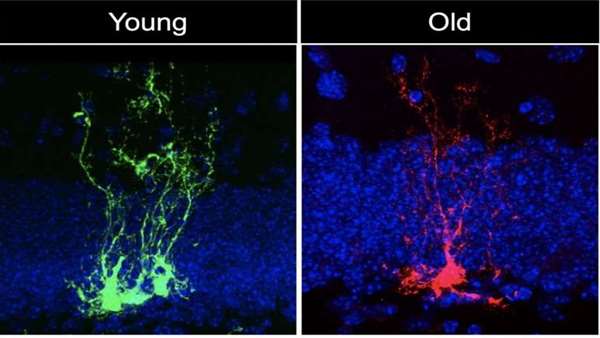 مطالعه ای نشان می دهد که سلول های بنیادی عصبی به سرعت پیر می شوند