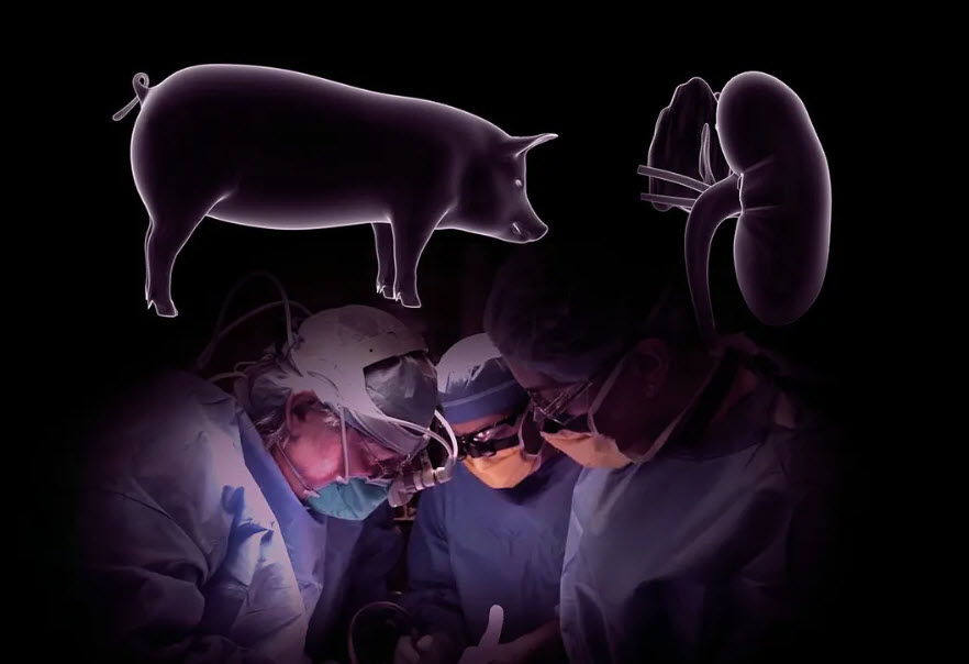 جراحان برای اولین بار موفق شدند که کلیه‌ی خوک را به انسان پیوند بزنند!