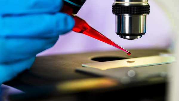اکتشافات سلول های بنیادی پتانسیلی برای بهبود درمان سرطان