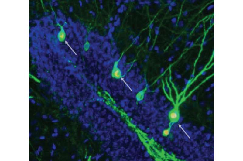 تقویت شکل گیری نورون باعث بازیابی حافظه در موش های مبتلا به ‏آلزایمر می شود. ‏
