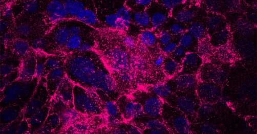سلول های مقاوم به استرس، نقطه شروع تشکیل تومورهای پانکراس