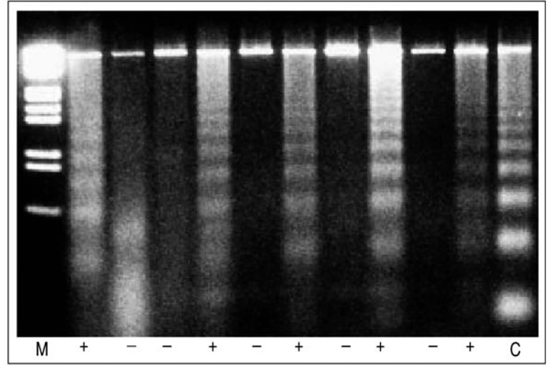 شکل 2-7 - ژل الکتروفورز برای DNA سلول¬های آپوپتوتيک شده با Camptothecin.M اندازة مارکر، سلول¬های کنترل بدون Camptothecin ، + سلول¬های مواجهه شده با Camptothecin و C سلول¬های کنترل مثبت.