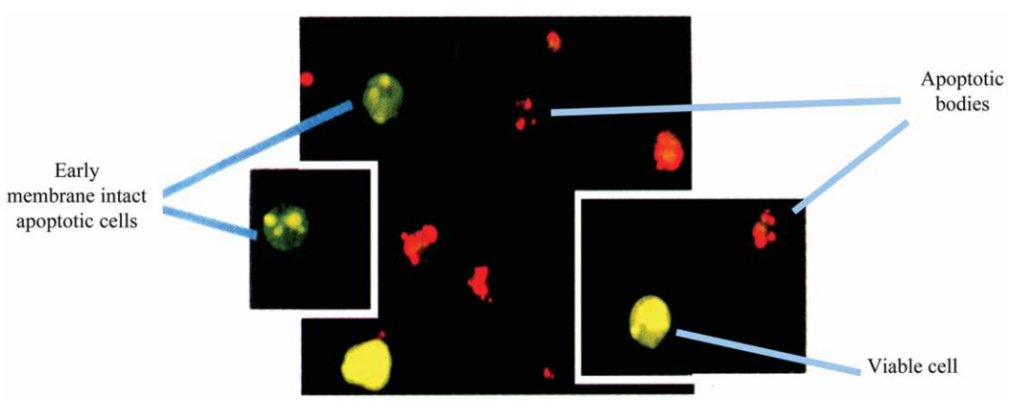 شکل 2-8 - آناليز ميکروسکوپ فلورسانس از سلول¬های هيبريدوما تحت تأثیر رنگ¬های حياتی آکریدین نارنجی و پروپیدیوم آیداد.
