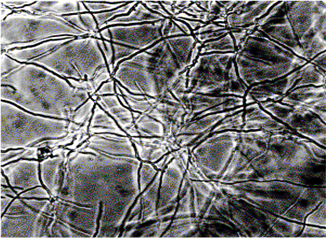 شکل 3-2 تصوير ميکروسکوپ نوری محيط کشت آلوده به قارچ. هيف¬ها يا میسليوم¬ها کاملاً مشخص هستند.