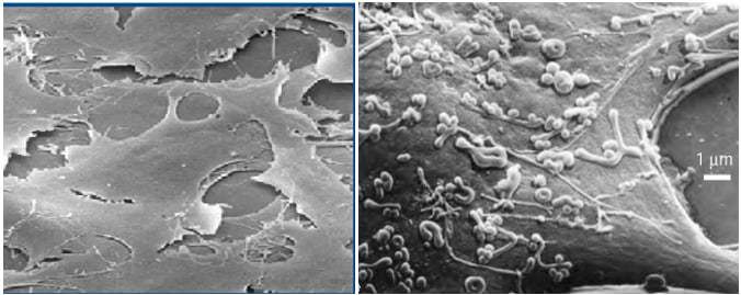شکل 3-4 تصوير ميکروسکوپ الکترونی محيط کشت آلوده به مايکوپلاسما(سمت چپ) و محيط کشت عاری از مايکوپلاسما (سمت راست).